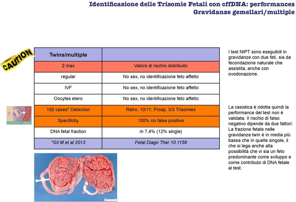 IVF No sex, no identificazione feto affetto Oocytes etero No sex, no identificazione feto affetto 192 cases* Detection Retro, 10/11; Prosp, 3/3 Trisomies Specificity 100% no false positive DNA fetal