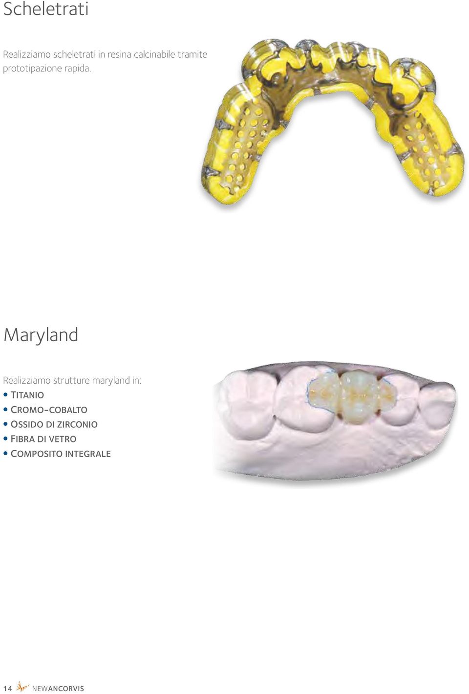 Maryland Realizziamo strutture maryland in: titanio
