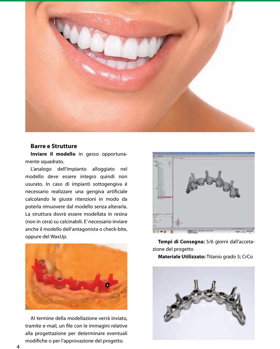 La struttura dovrà essere modellata in resina (non in cera) su calcinabili. E necessario inviare anche il modello dell antagonista o check-bite, oppure del WaxUp.