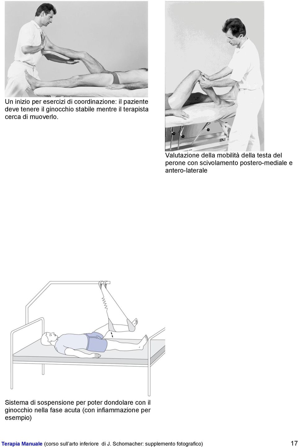 Valutazione della mobilità della testa del perone con scivolamento postero-mediale e antero-laterale