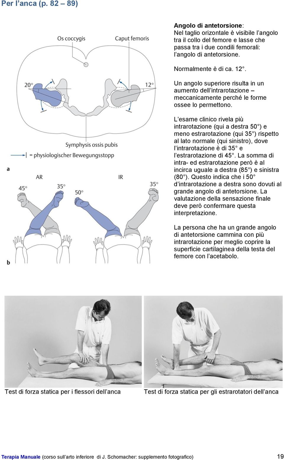 L esame clinico rivela più intrarotazione (qui a destra 50 ) e meno estrarotazione (qui 35 ) rispetto al lato normale (qui sinistro), dove l intrarotazione è di 35 e l estrarotazione di 45.