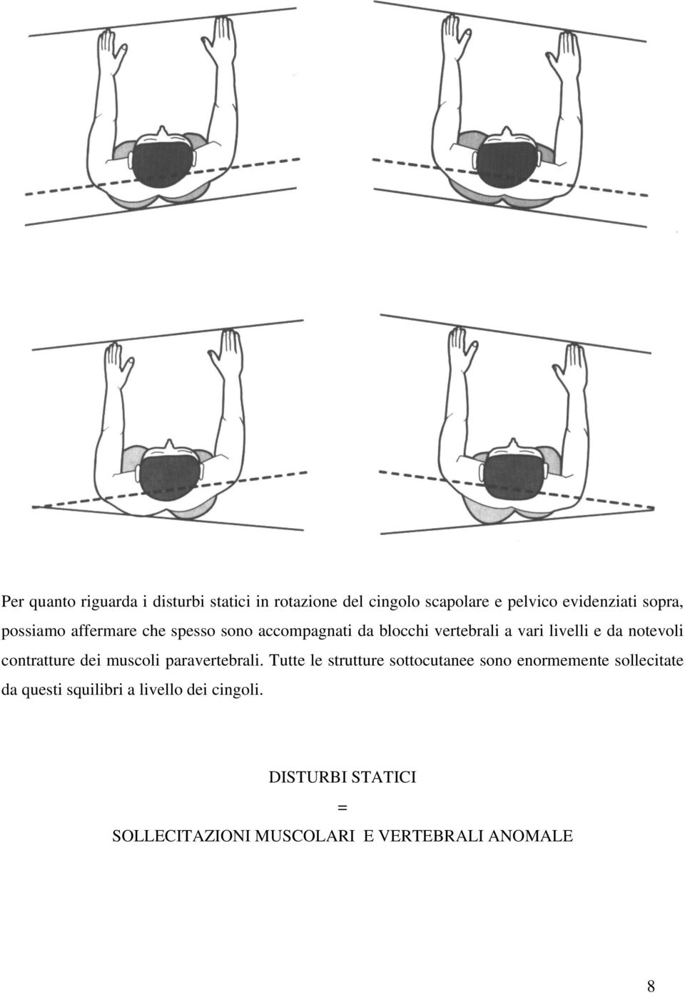 contratture dei muscoli paravertebrali.