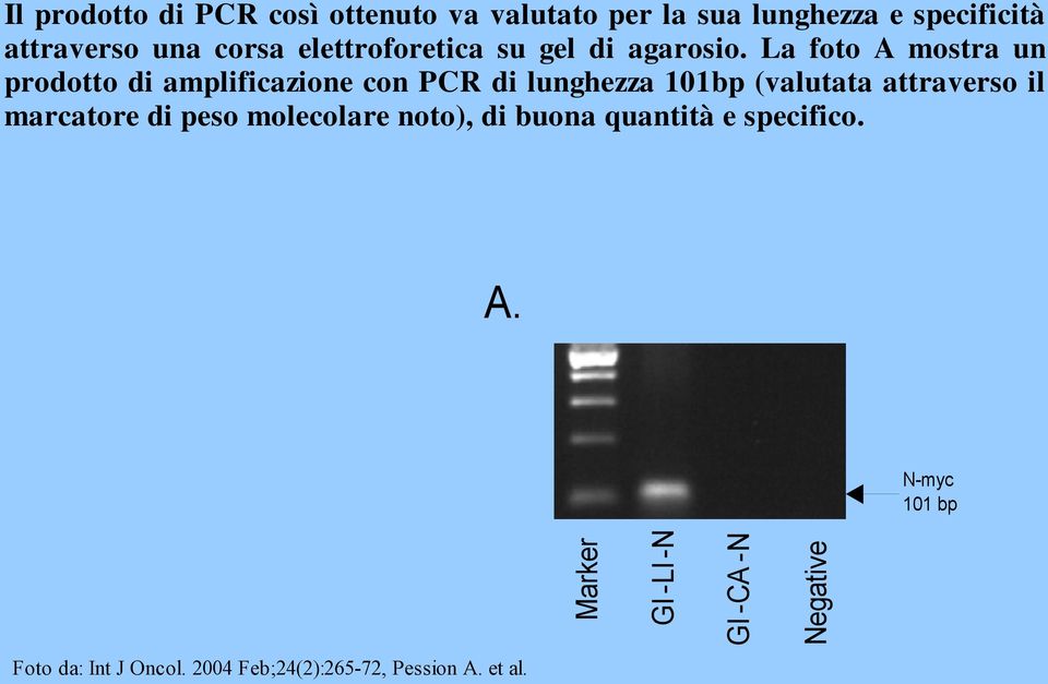 La foto A mostra un prodotto di amplificazione con PCR di lunghezza 101bp (valutata attraverso il