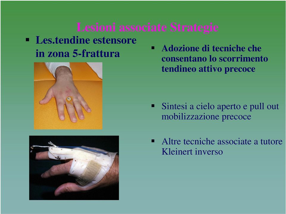 Adozione di tecniche che consentano lo scorrimento tendineo