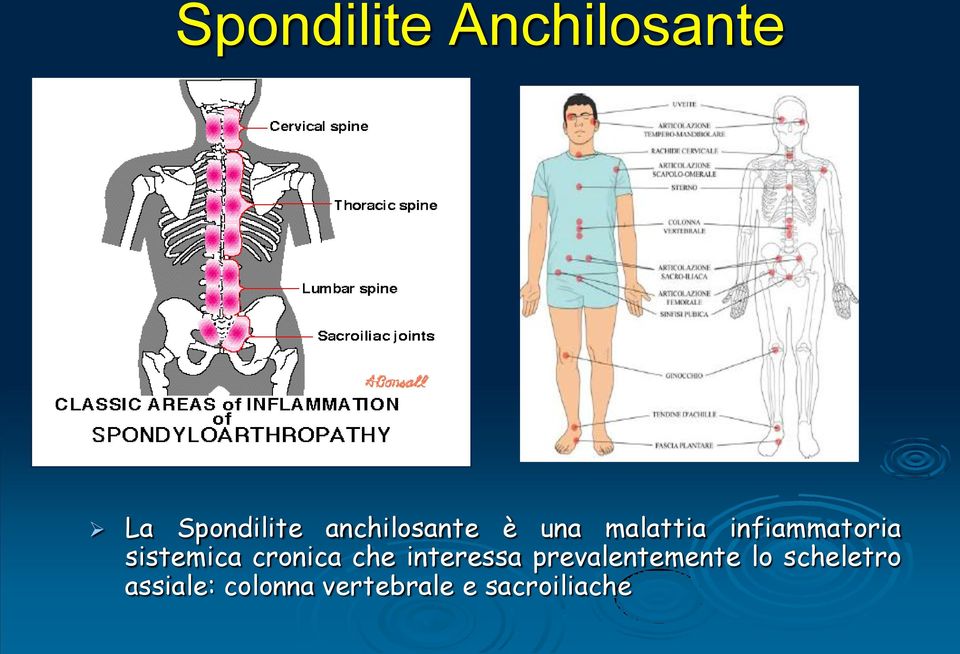 sistemica cronica che interessa