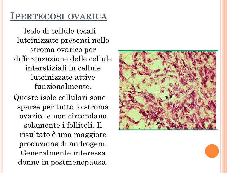 Queste isole cellulari sono sparse per tutto lo stroma ovarico e non circondano solamente i