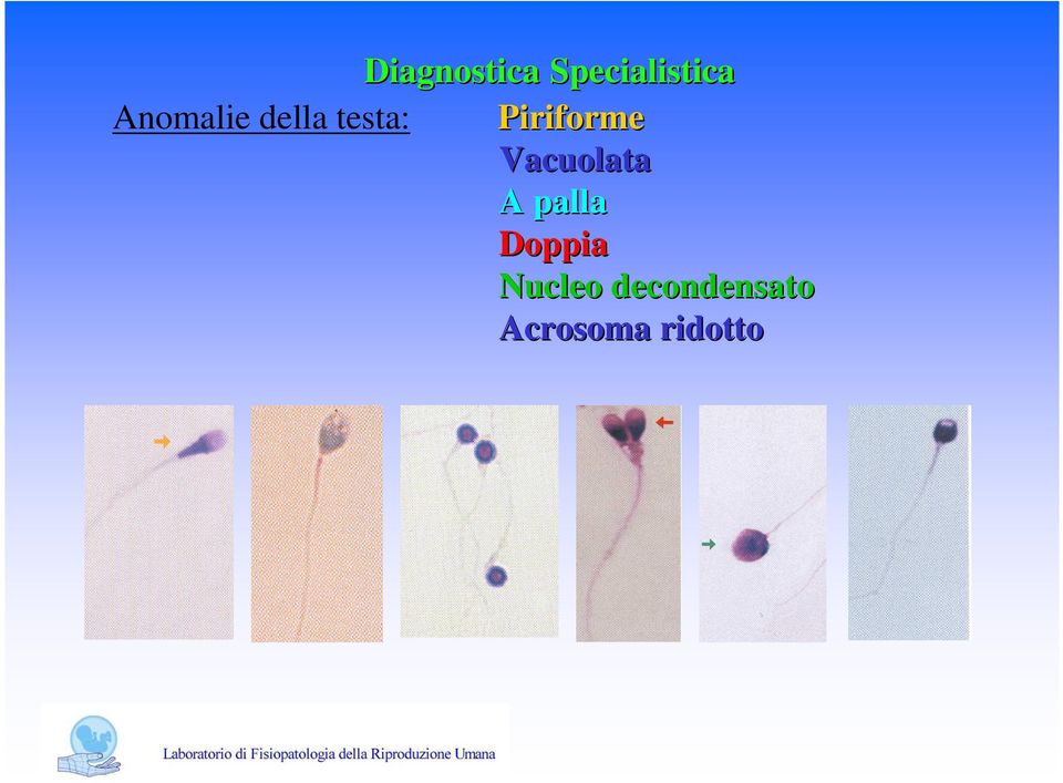 Piriforme Vacuolata A palla