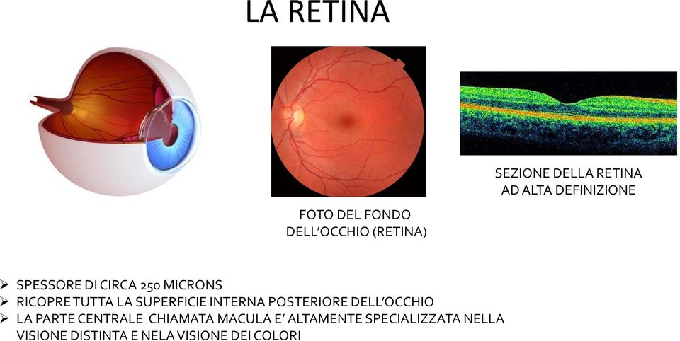 SUPERFICIE INTERNA POSTERIORE DELL OCCHIO LA PARTE CENTRALE CHIAMATA