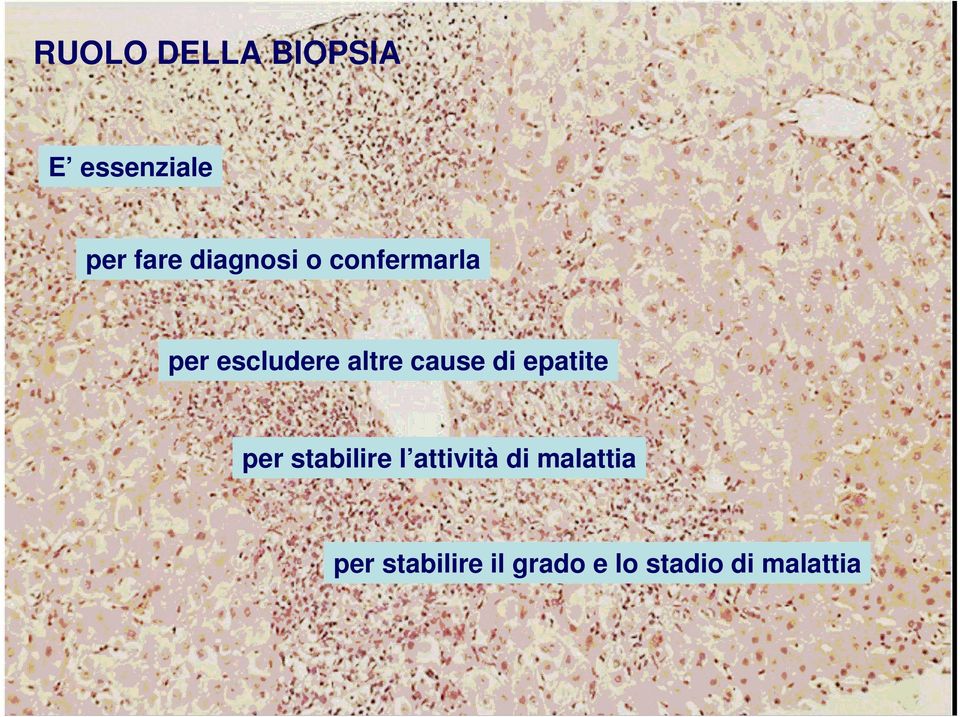 cause di epatite per stabilire l attività di