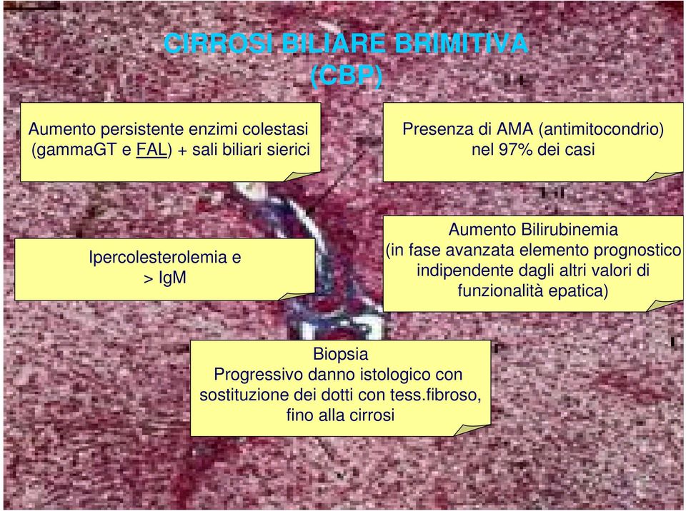 Bilirubinemia (in fase avanzata elemento prognostico indipendente dagli altri valori di funzionalità