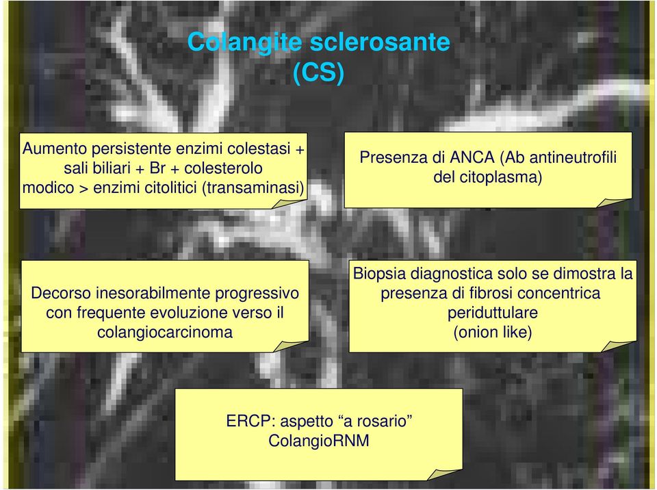 inesorabilmente progressivo con frequente evoluzione verso il colangiocarcinoma Biopsia diagnostica