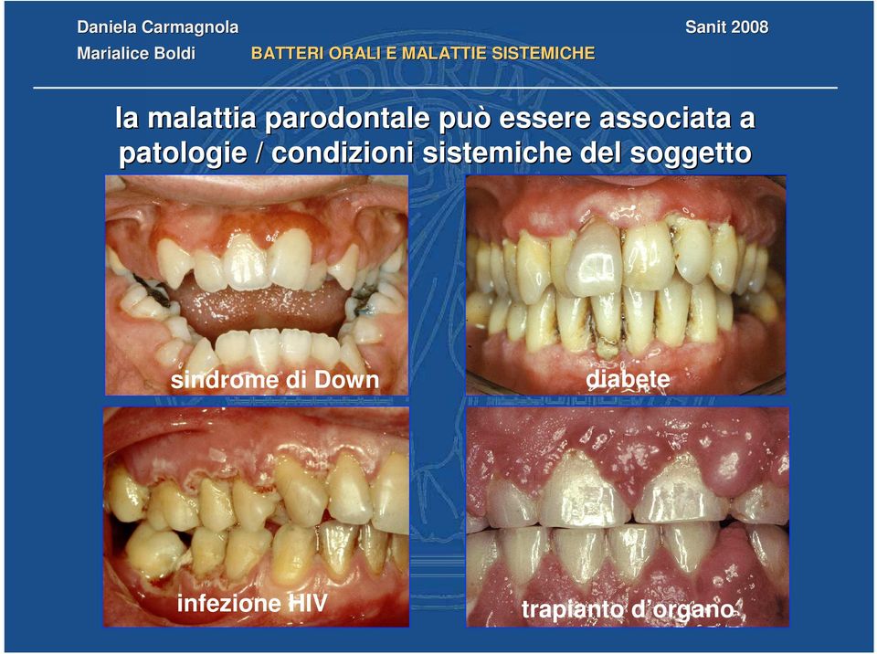 sistemiche del soggetto sindrome di