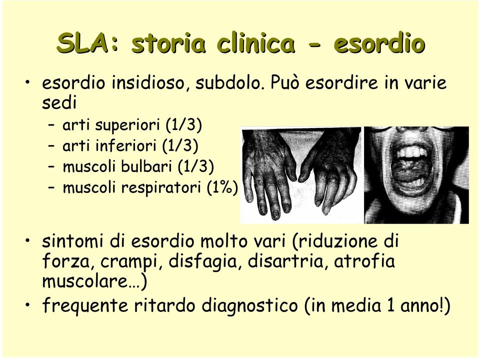 bulbari (1/3) muscoli respiratori (1%) sintomi di esordio molto vari (riduzione