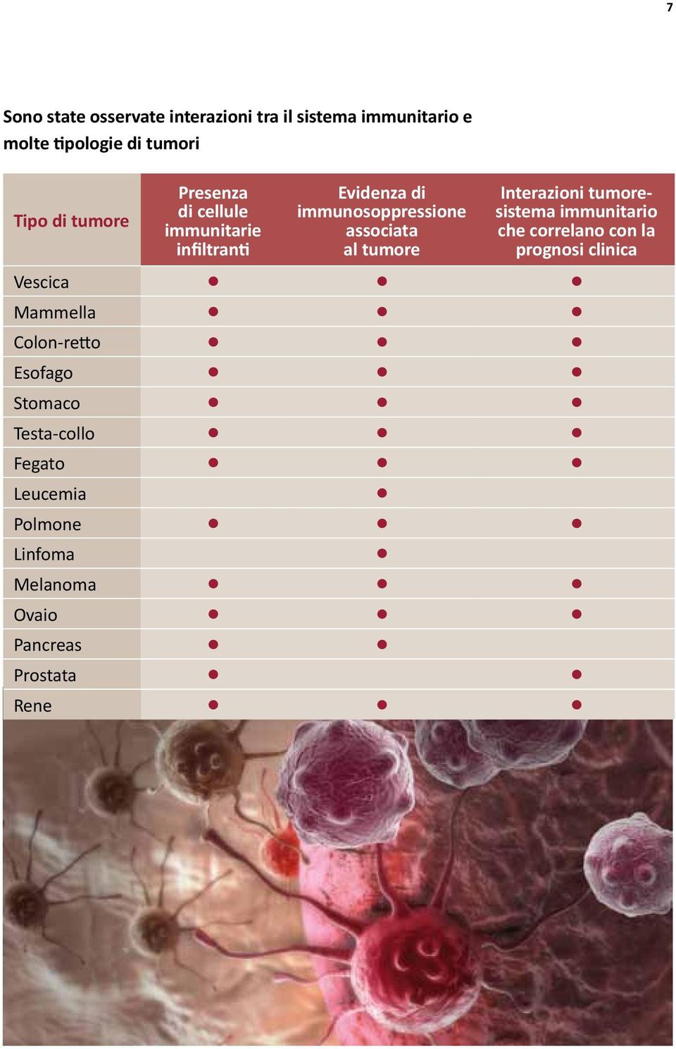 tumore Interazioni tumoresistema immunitario che correlano con la prognosi clinica Vescica Mammella