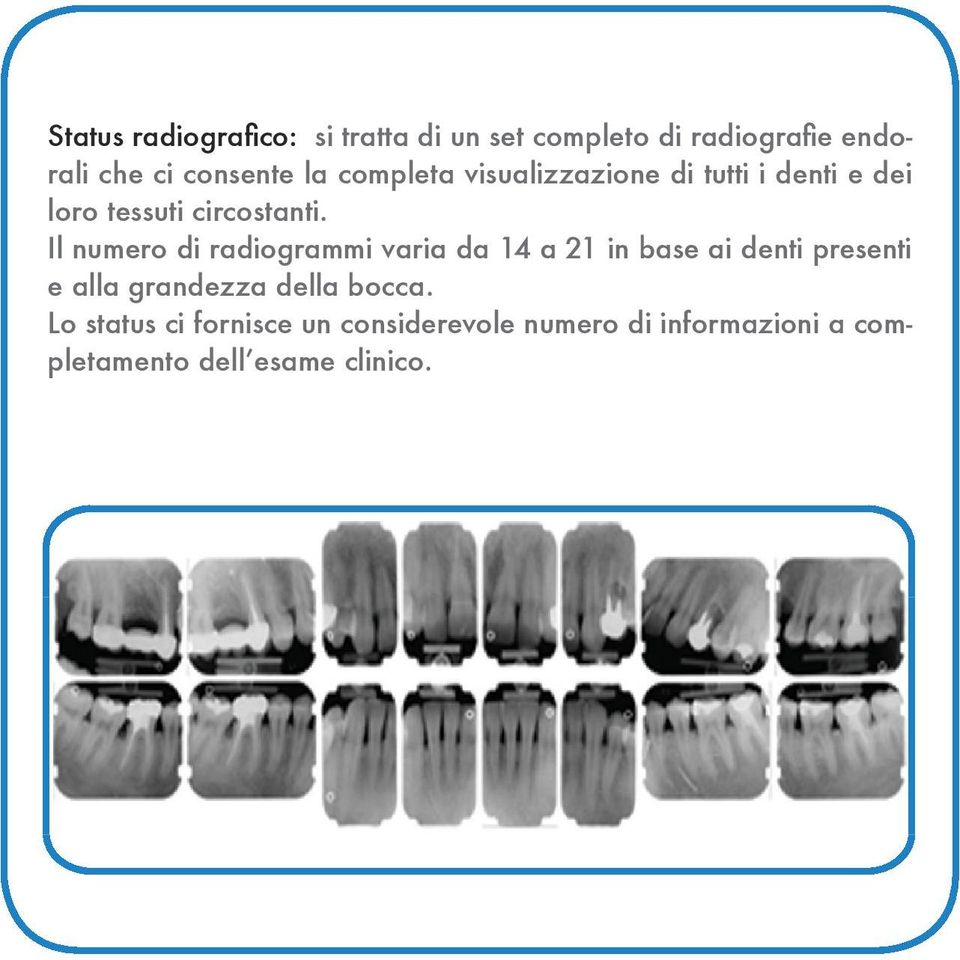 Il numero di radiogrammi varia da 14 a 21 in base ai denti presenti e alla grandezza della