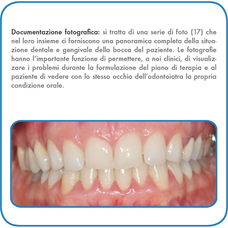 Le fotografie hanno l importante funzione di permettere, a noi clinici, di visualizzare i problemi