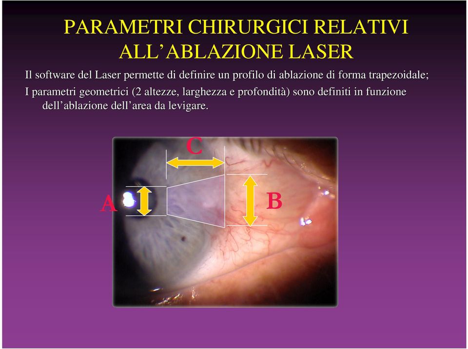 trapezoidale; I parametri geometrici (2 altezze, larghezza e