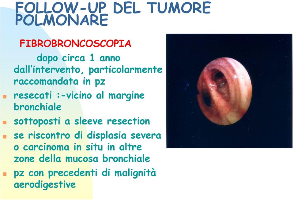 sleeve resection se riscontro di displasia severa o carcinoma in situ in