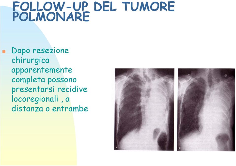 possono presentarsi recidive