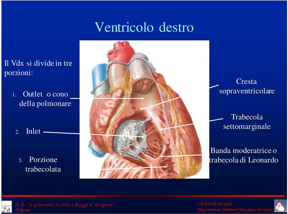 Porzione trabecolata Cresta sopraventricolare