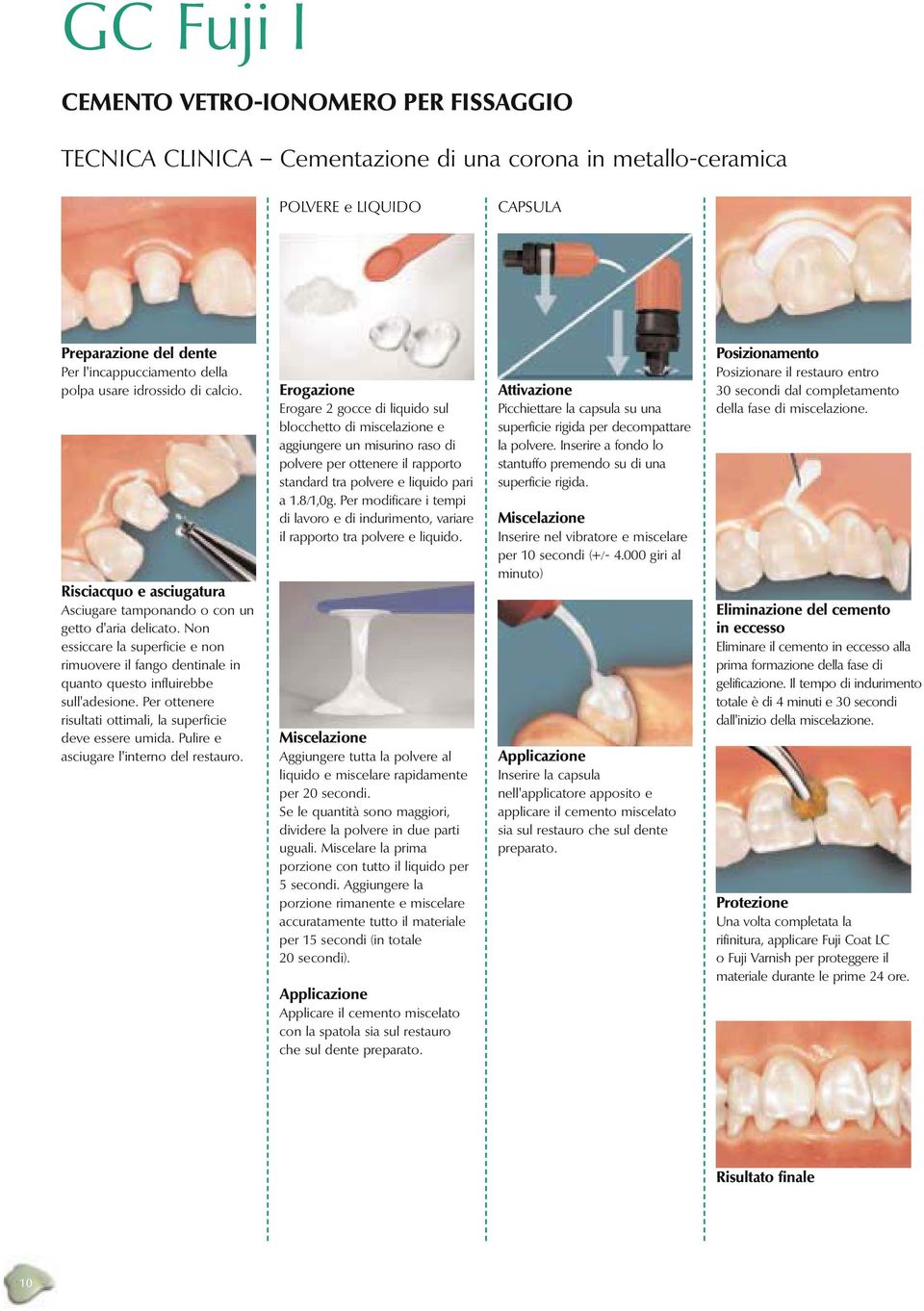 Non essiccare la superficie e non rimuovere il fango dentinale in quanto questo influirebbe sull'adesione. Per ottenere risultati ottimali, la superficie deve essere umida.