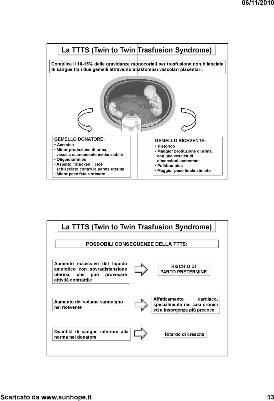 RICEVENTE: Pletorico Maggior produzione di urina, con una vescica di dimensioni aumentate Polidramnios Maggior peso fetale stimato La TTTS (Twin to Twin Trasfusion Syndrome) POSSOBILI CONSEGUENZE