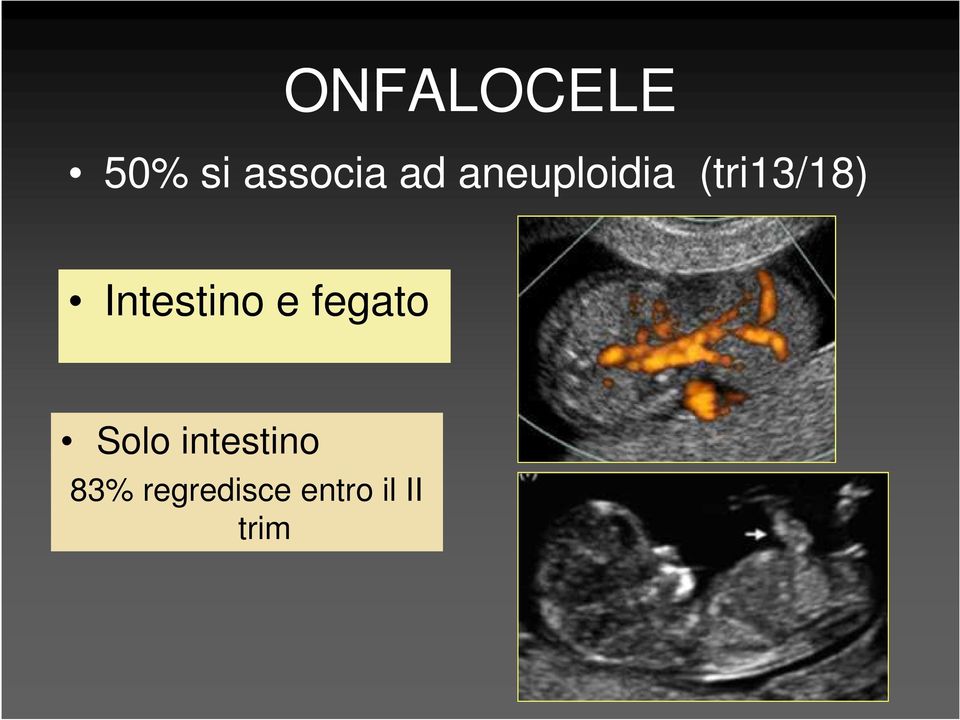 Intestino e fegato Solo