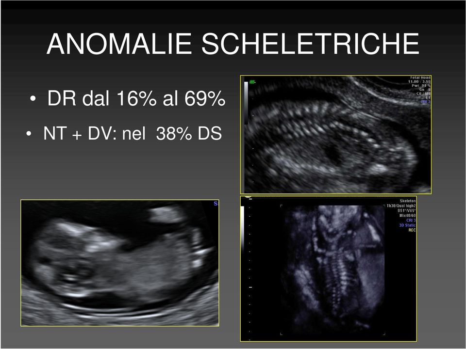 DR dal 16% al