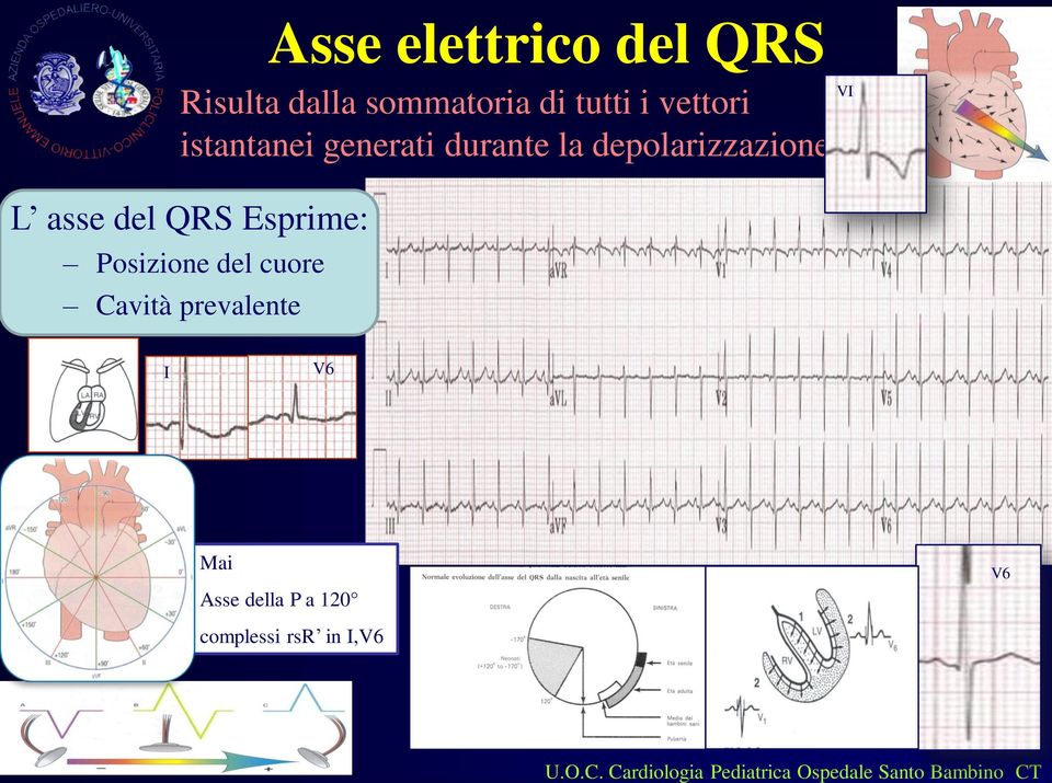 L asse del QRS Esprime: Posizione del cuore Cavità