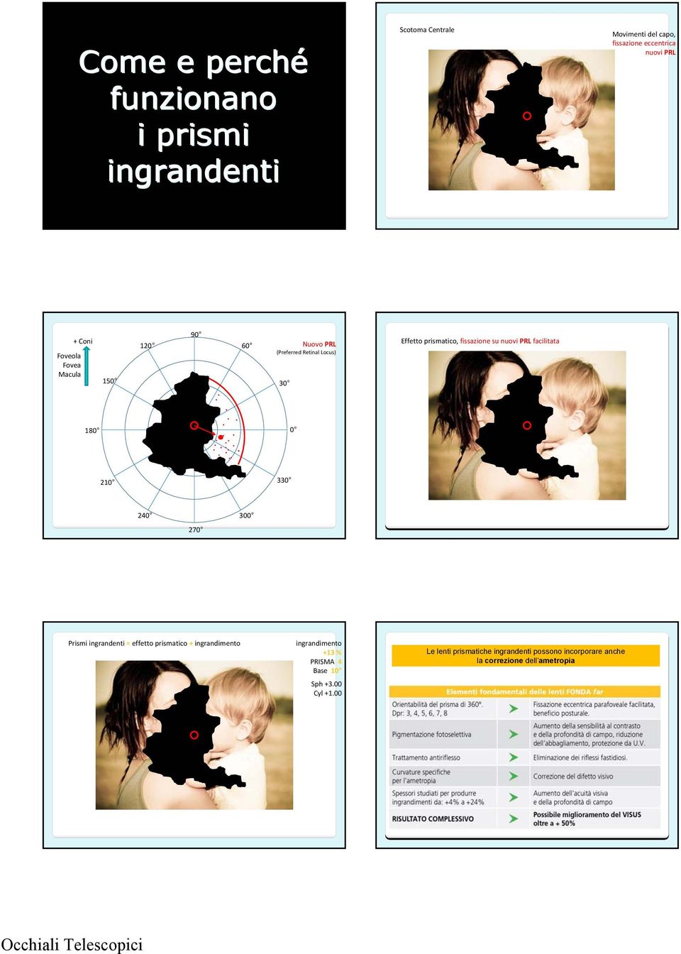 Macula 150 30 180 0 210 330 240 270 300 Prismi ingrandenti = effetto prismatico + ingrandimento ingrandimento +13 %