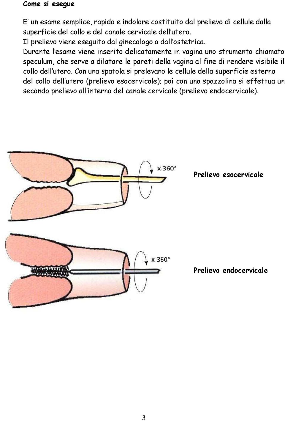 Durante l esame viene inserito delicatamente in vagina uno strumento chiamato speculum, che serve a dilatare le pareti della vagina al fine di rendere visibile il