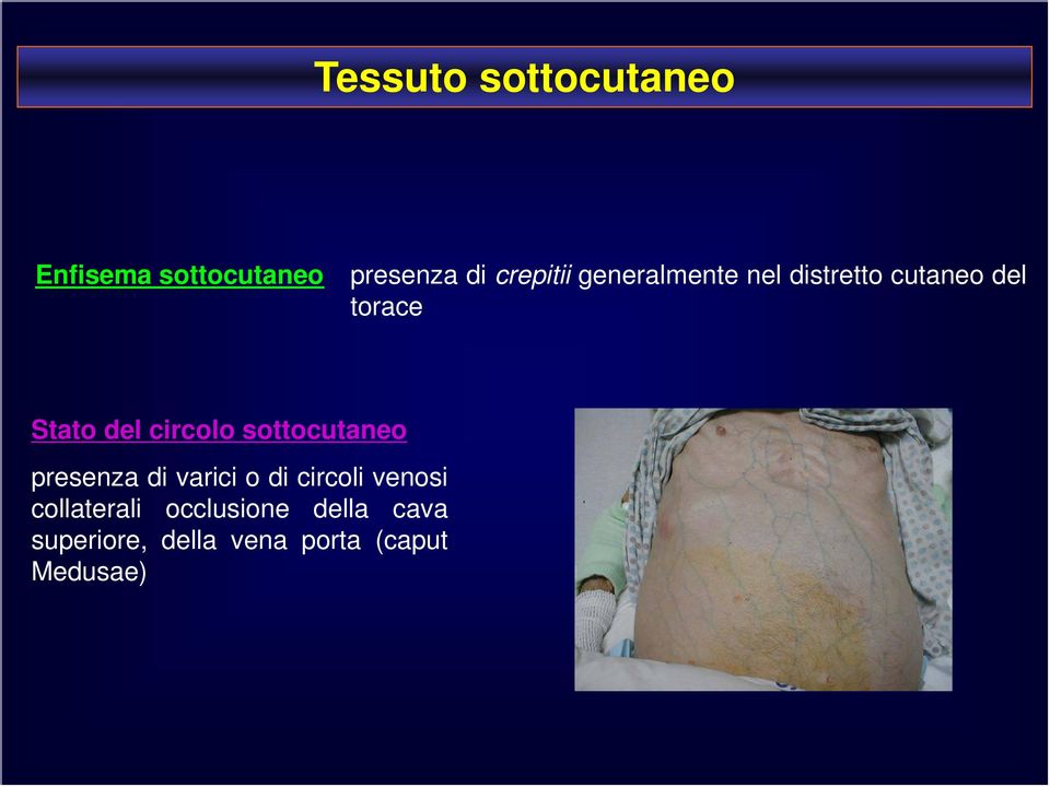 sottocutaneo presenza di varici o di circoli venosi collaterali