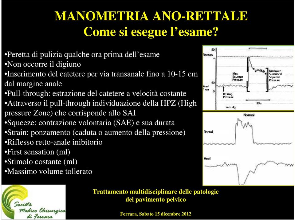 margine anale Pull-through: estrazione del catetere a velocità costante Attraverso il pull-through individuazione della HPZ (High pressure