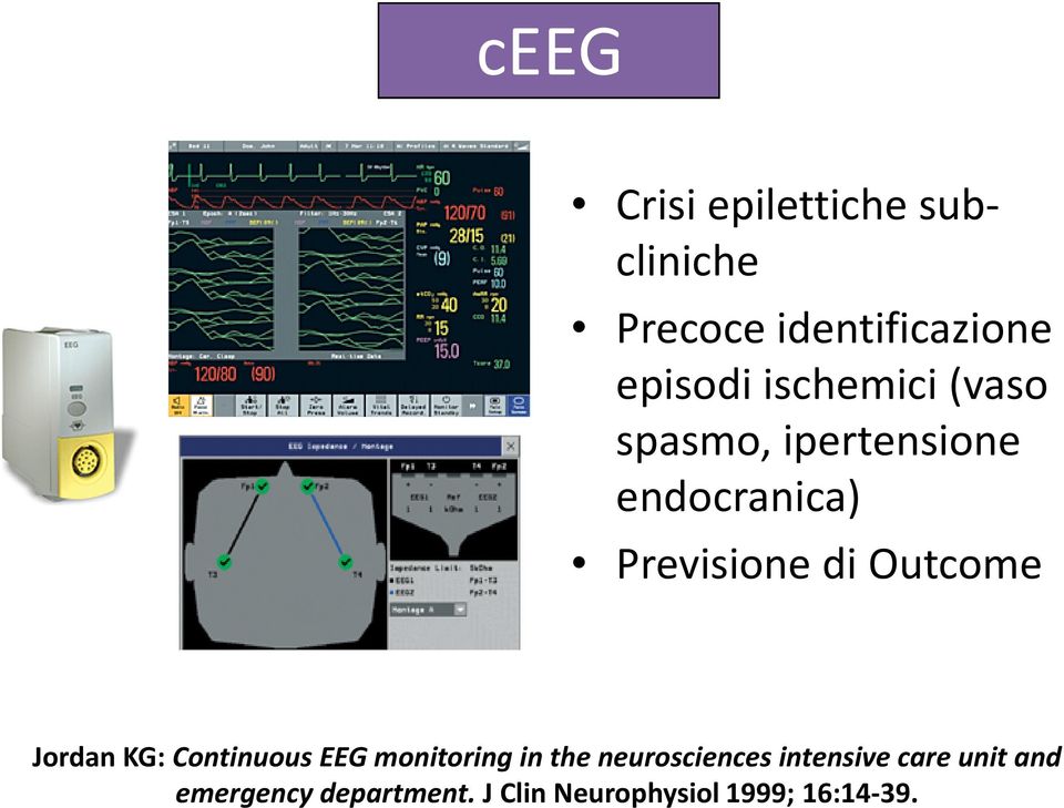 Outcome Jordan KG: Continuous EEG monitoring in the neurosciences