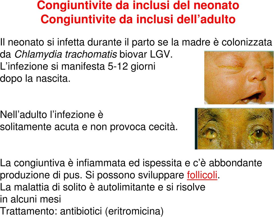 Nell adulto l infezione è solitamente acuta e non provoca cecità.