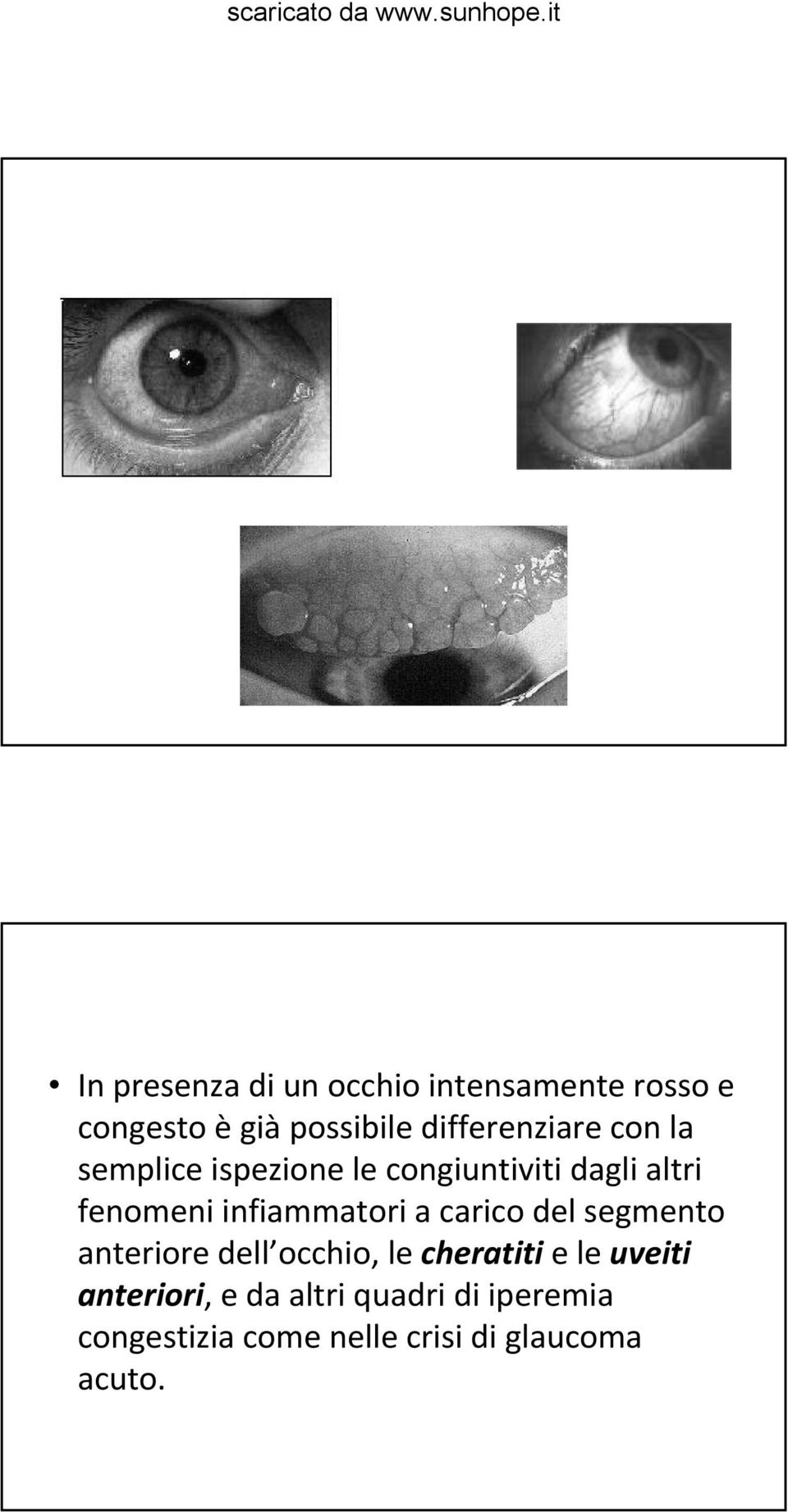 infiammatori a carico del segmento anteriore dell occhio, le cheratiti e le
