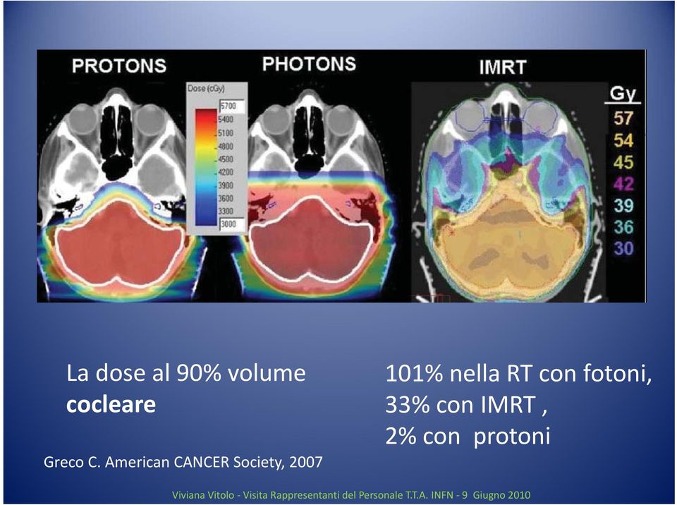 RT con fotoni, 33% con IMRT, 2% con