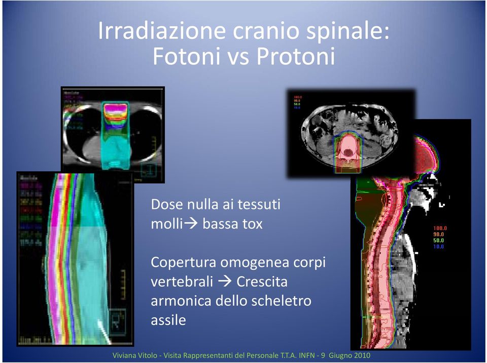 omogenea corpi vertebrali Crescita armonica dello