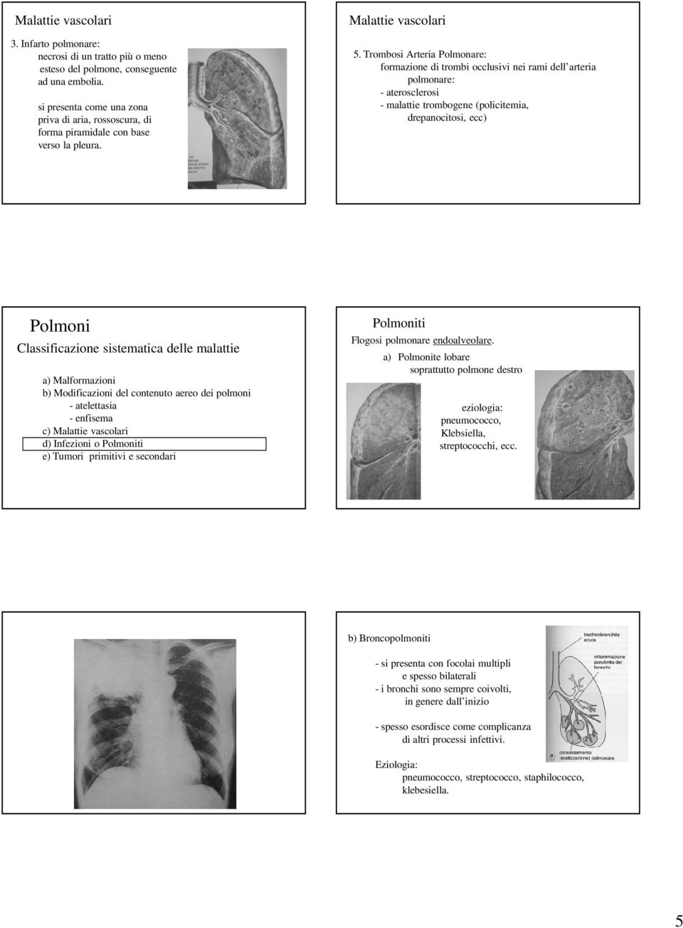 Trombosi Arteria Polmonare: formazione di trombi occlusivi nei rami dell arteria polmonare: - aterosclerosi - malattie trombogene (policitemia, drepanocitosi, ecc) Polmoni Classificazione sistematica