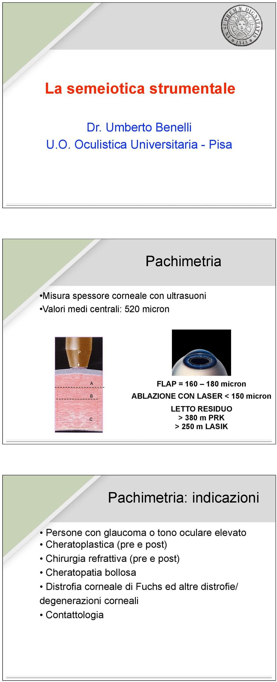 160 180 micron ABLAZIONE CON LASER < 150 micron LETTO RESIDUO > 380 m PRK > 250 m LASIK Pachimetria: indicazioni Persone con