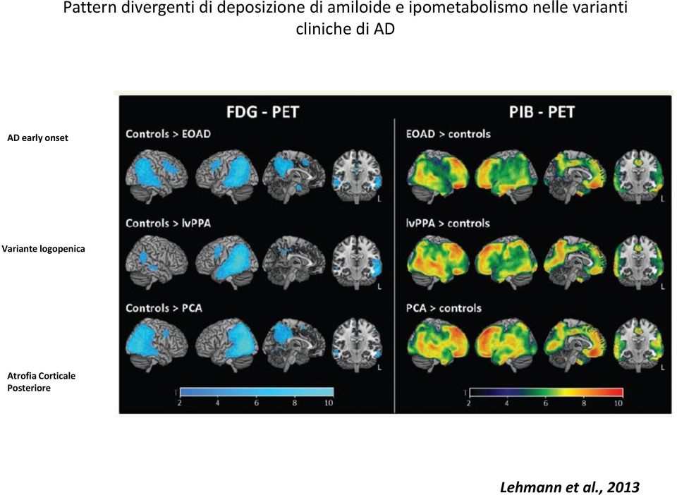 cliniche di AD AD early onset Variante