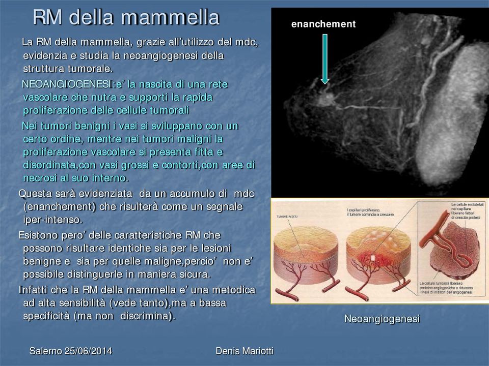 maligni la proliferazione vascolare si presenta fitta e disordinata,con vasi grossi e contorti,con aree di necrosi al suo interno.