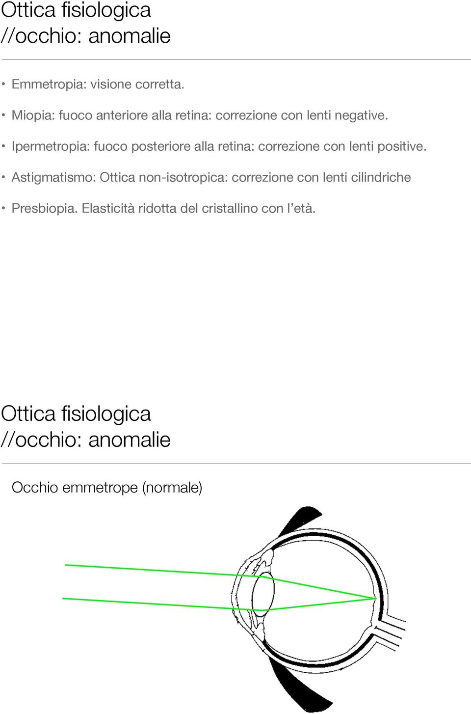 Iermetroia: fuoco osteriore alla retina: correzione con lenti ositive.