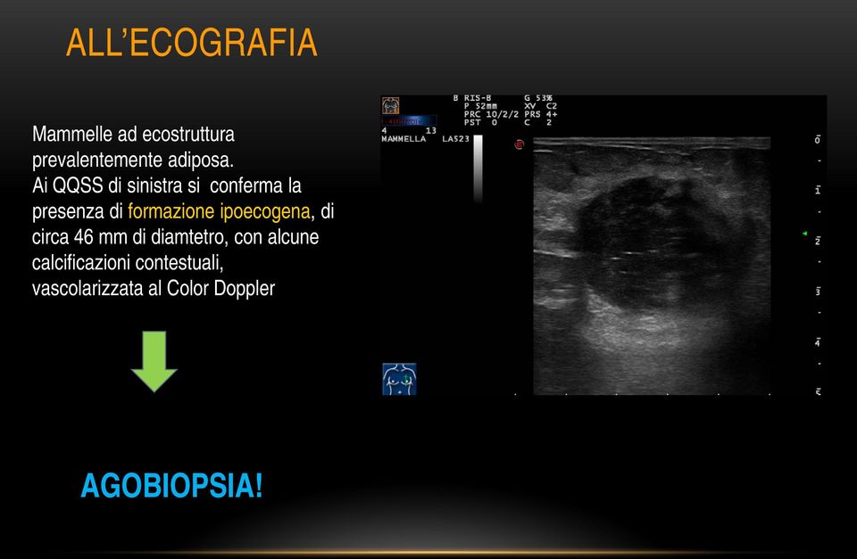 Ai QQSS di sinistra si conferma la presenza di formazione