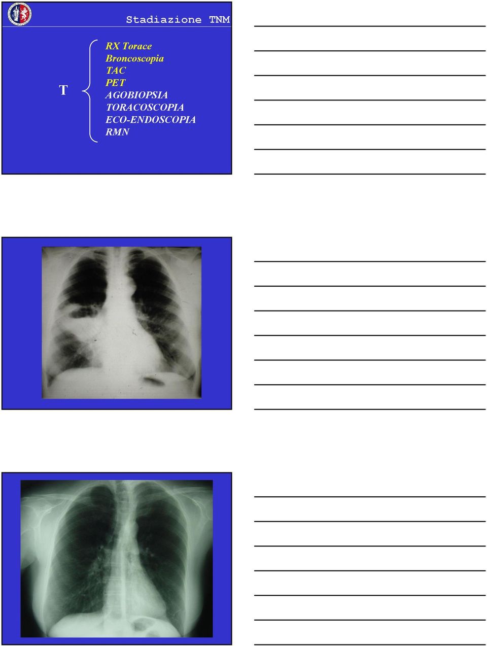 TAC PET AGOBIOPSIA