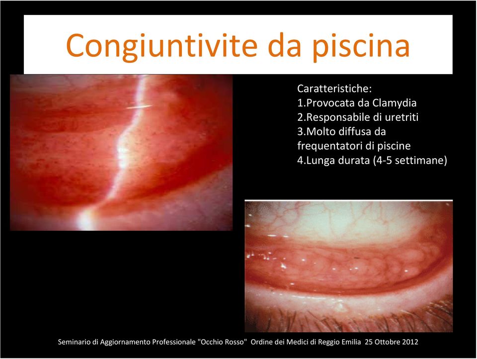 Responsabile di uretriti 3.