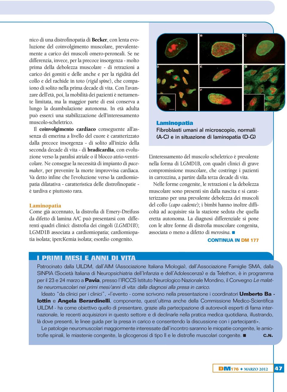 spine), che compaiono di solito nella prima decade di vita.