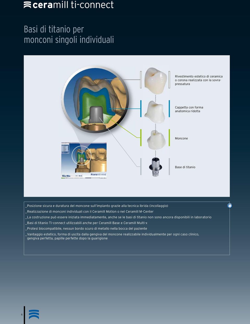 iniziata immediatamente, anche se le basi di titanio non sono ancora disponibili in laboratorio _ Basi di titanio Ti-connect utilizzabili anche per Ceramill Base e Ceramill Multi-x _ Protesi