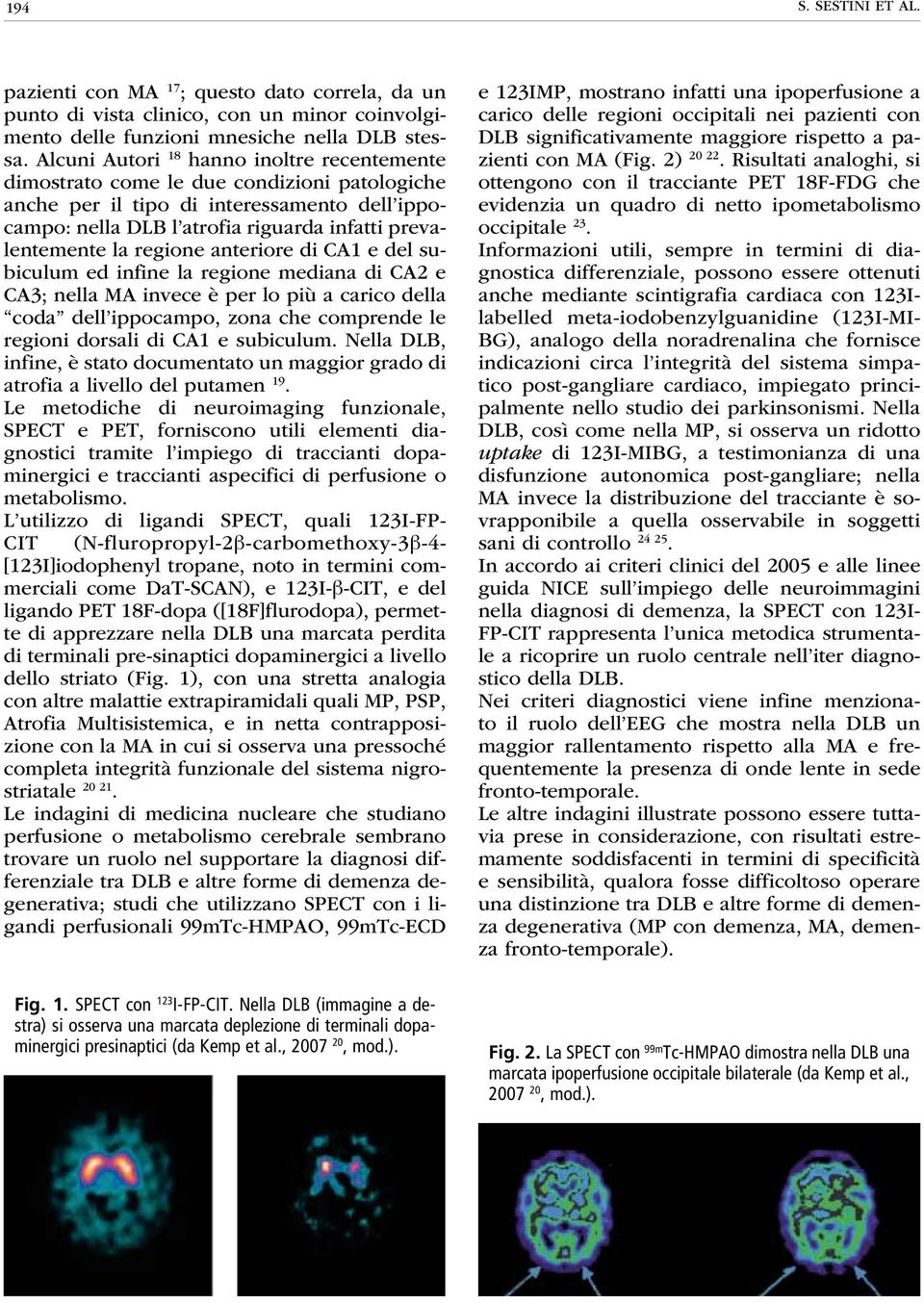 regione anteriore di CA1 e del subiculum ed infine la regione mediana di CA2 e CA3; nella MA invece è per lo più a carico della coda dell ippocampo, zona che comprende le regioni dorsali di CA1 e