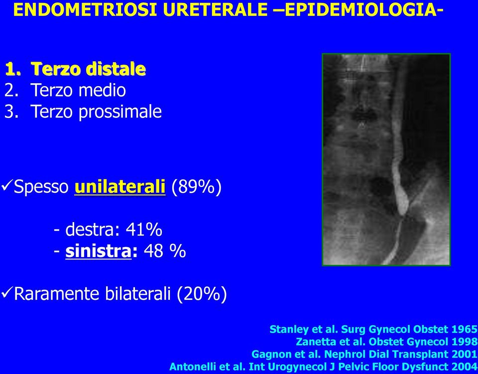 bilaterali (20%) Stanley et al. Surg Gynecol Obstet 1965 Zanetta et al.